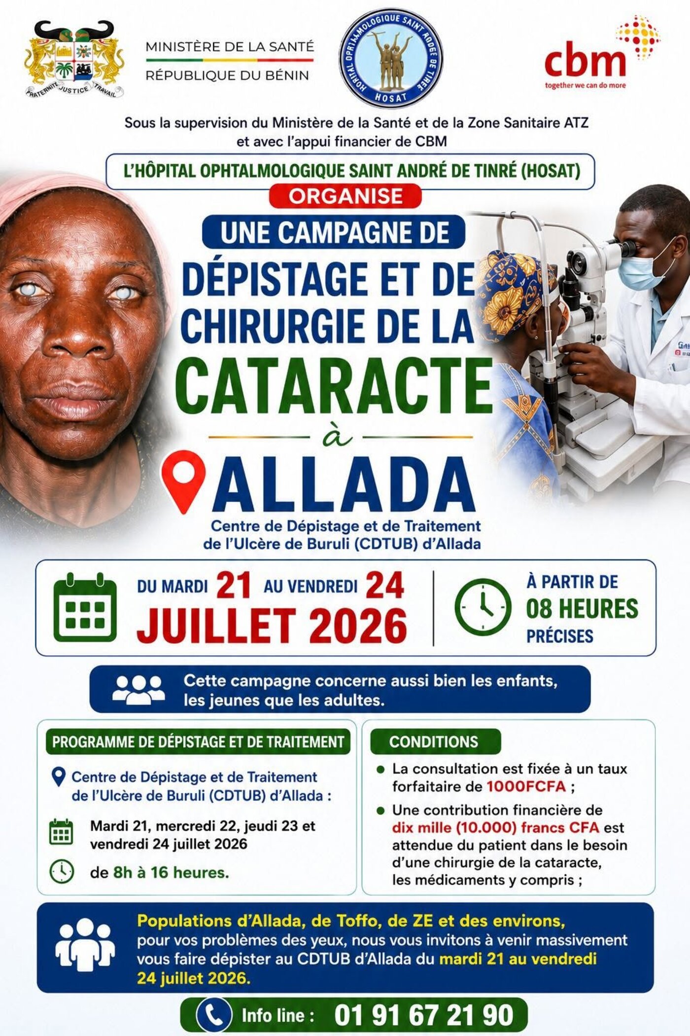 Campagne de dépistage et chirurgie de la cataracte à Allada, 21-24 juillet 2026