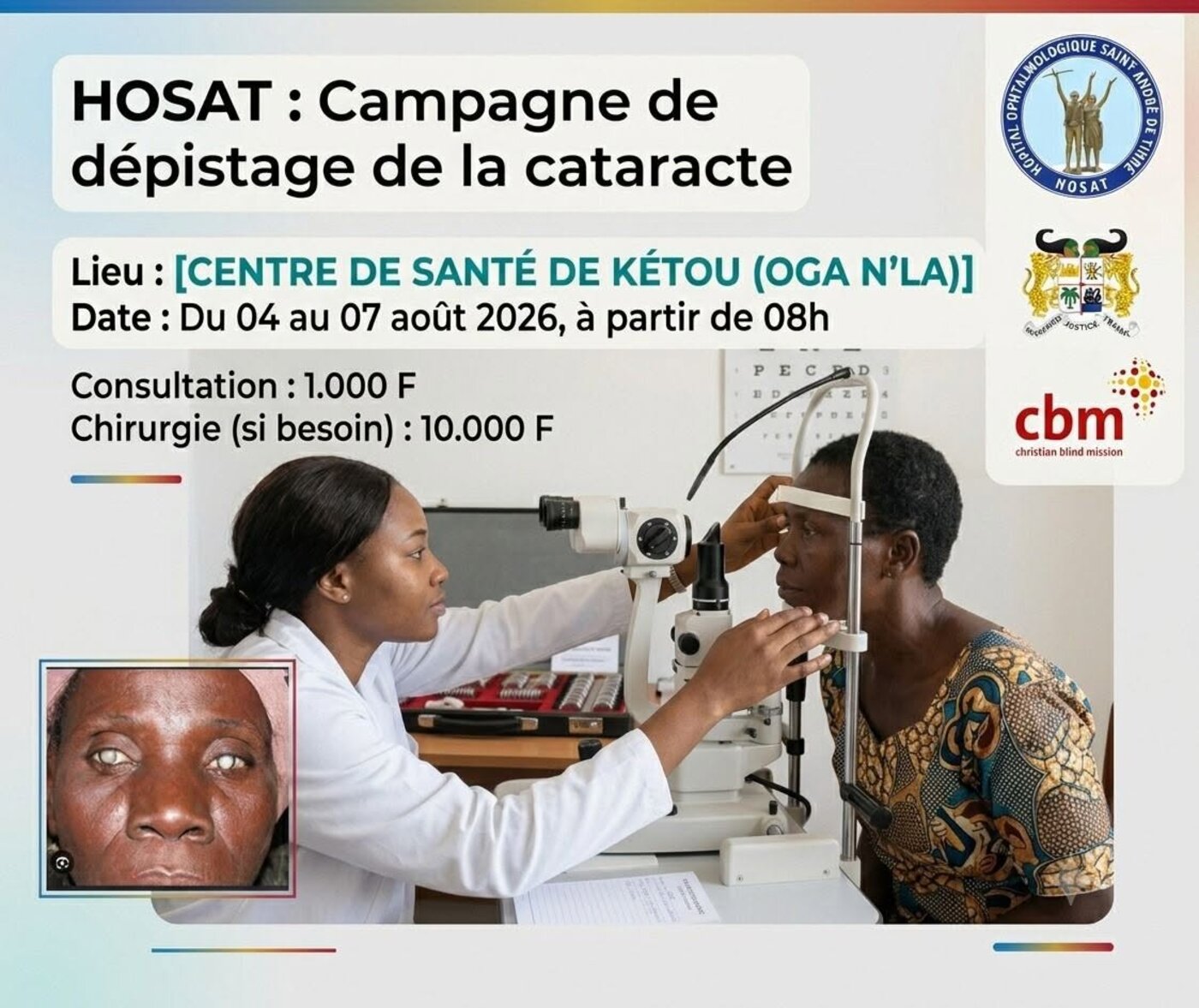 Campagne de dépistage de la cataracte à Kétou, 4-7 août 2026